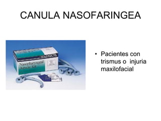 CANULA NASOFARINGEA
• Pacientes con
trismus o injuria
maxilofacial
 