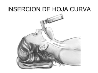 INSERCION DE HOJA CURVA
 