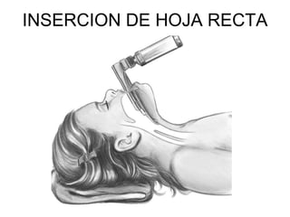 INSERCION DE HOJA RECTA
 