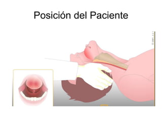 Posición del Paciente
 