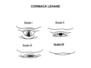 CORMACK LEHANE
 