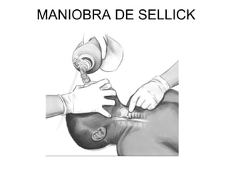 MANIOBRA DE SELLICK
 