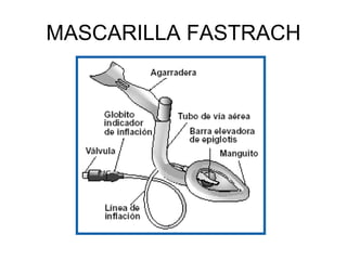 MASCARILLA FASTRACH
 