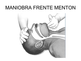 MANIOBRA FRENTE MENTON
 