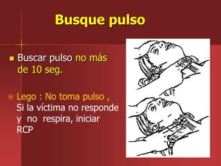 Busque pulso
 Buscar pulso no más
de 10 seg.
 Lego : No toma pulso ,
Si la víctima no responde
y no respira, iniciar
RCP
 