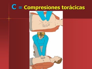 C = Compresiones torácicas
 