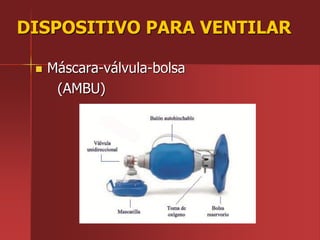 DISPOSITIVO PARA VENTILAR
 Máscara-válvula-bolsa
(AMBU)
 