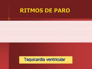 RITMOS DE PARO
Taquicardia ventricular
 