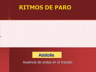 Asistolia
Ausencia de ondas en el trazado
RITMOS DE PARO
 