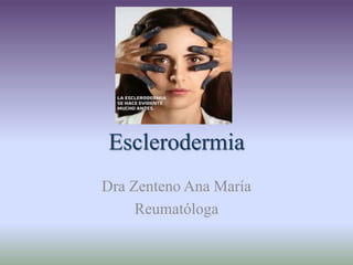 Esclerodermia
Dra Zenteno Ana María
Reumatóloga
 