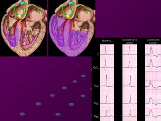 Comprehensive Guide to Cardiac Rhythms and AV Blocks in ECG ...