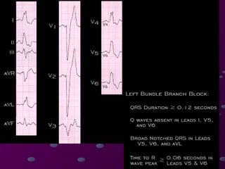 Comprehensive Guide to Cardiac Rhythms and AV Blocks in ECG ...
