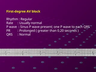 Comprehensive Guide to Cardiac Rhythms and AV Blocks in ECG ...