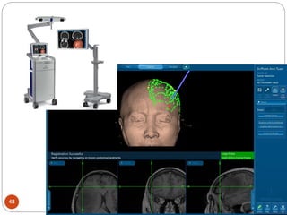 Comprehensive Overview of Brain Tumors: Diagnosis and Treatment | PDF