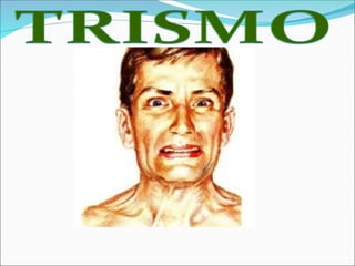 AULA DOENCAS BACTERIANA TUBERCULOSE E HANSENÍASE