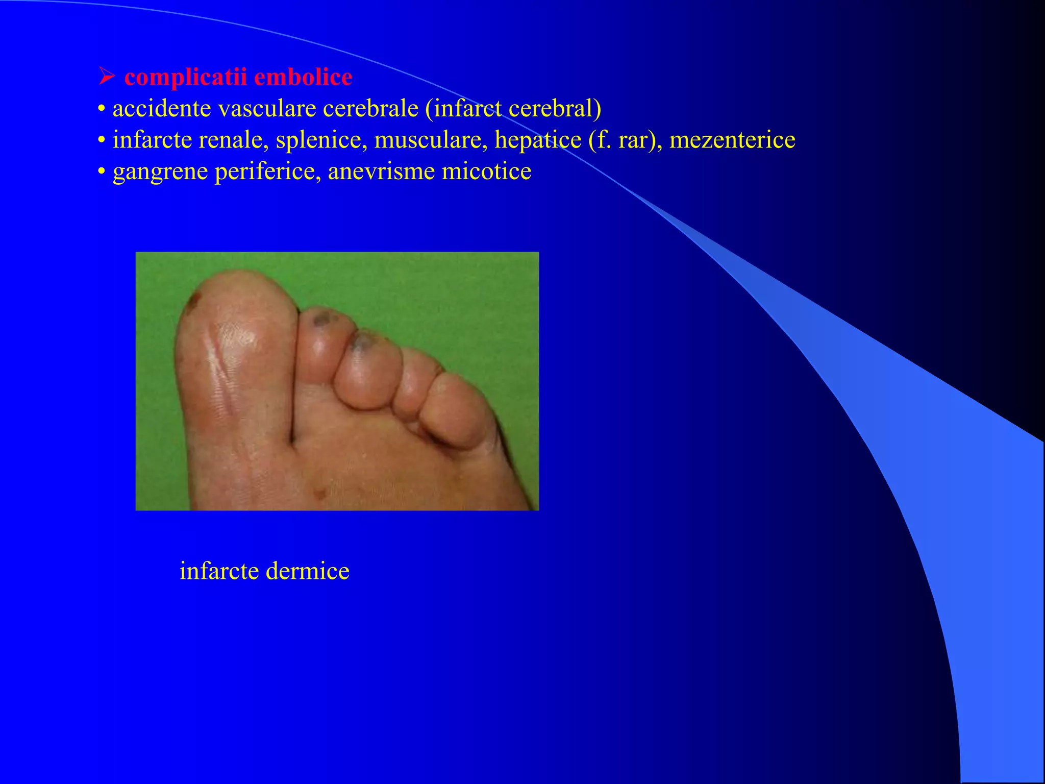  complicatii embolice
• accidente vasculare cerebrale (infarct cerebral)
• infarcte renale, splenice, musculare, hepatice (f. rar), mezenterice
• gangrene periferice, anevrisme micotice
infarcte dermice
 