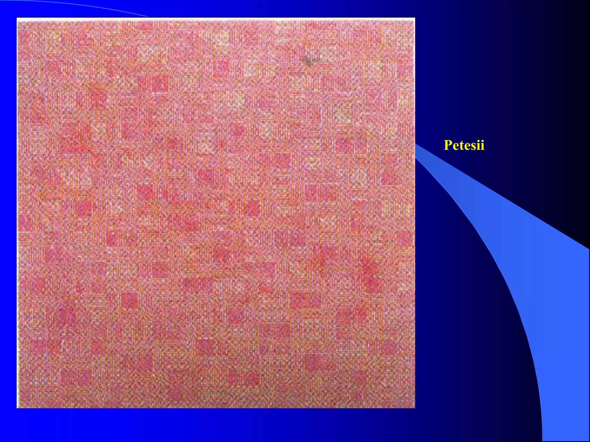 Petesii
 