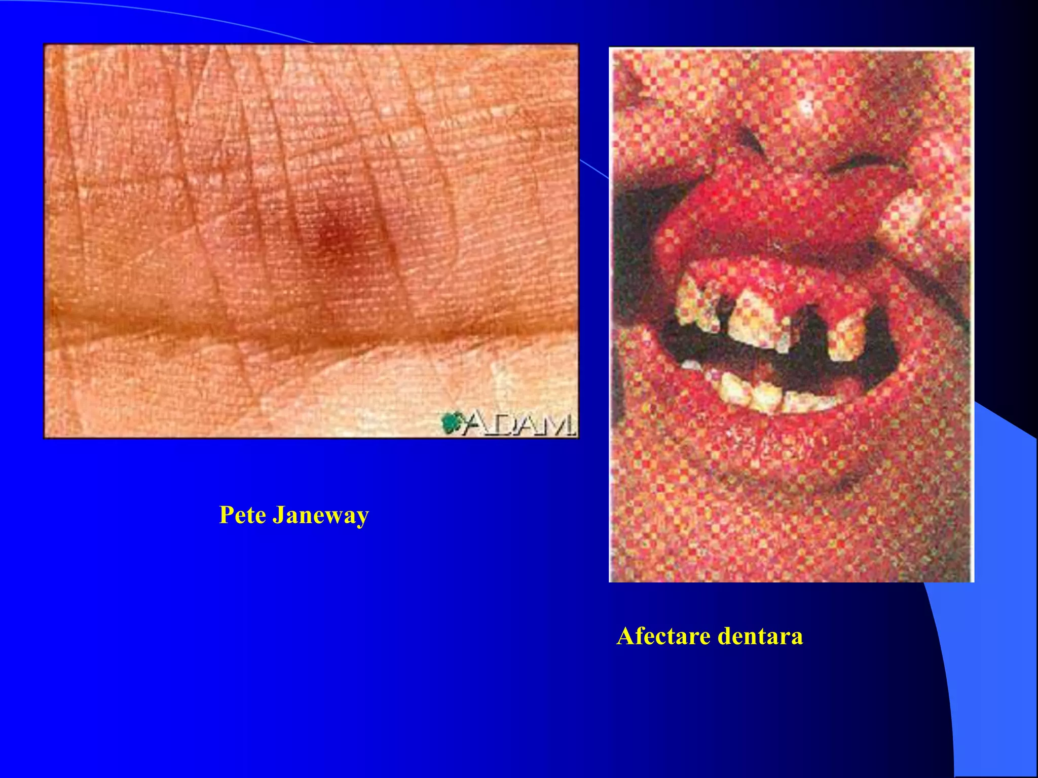 Pete Janeway
Afectare dentara
 