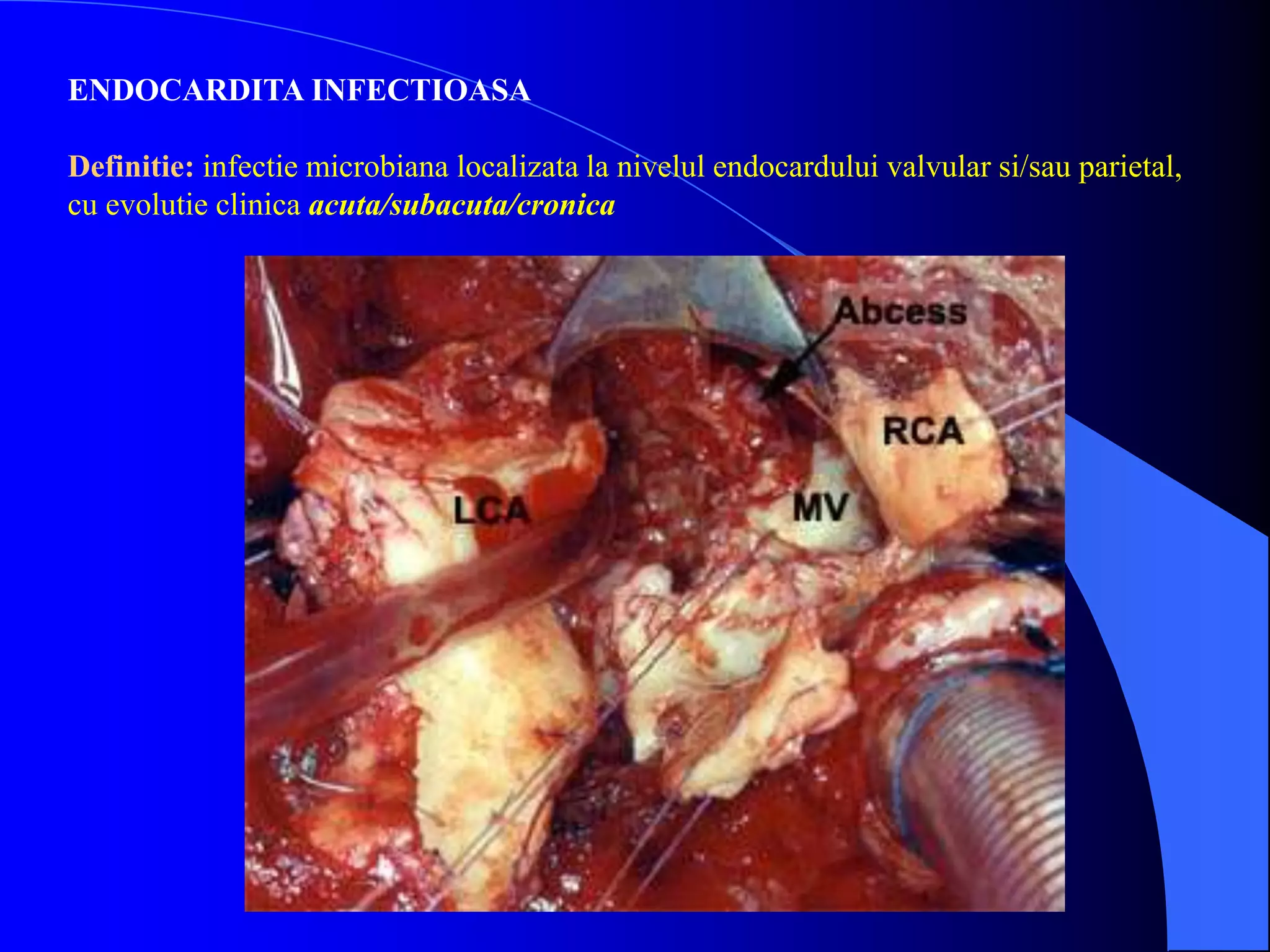ENDOCARDITA INFECTIOASA
Definitie: infectie microbiana localizata la nivelul endocardului valvular si/sau parietal,
cu evolutie clinica acuta/subacuta/cronica
 