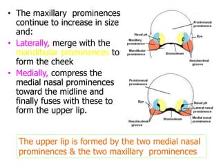 • The maxillary prominences
continue to increase in size
and:
• Laterally, merge with the
mandibular prominences to
form the cheek
• Medially, compress the
medial nasal prominences
toward the midline and
finally fuses with these to
form the upper lip.
The upper lip is formed by the two medial nasal
prominences & the two maxillary prominences
 