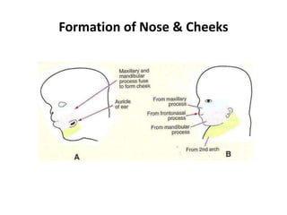 Formation of Nose & Cheeks
 