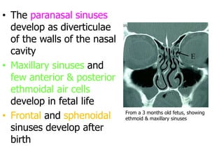 • The paranasal sinuses
develop as diverticulae
of the walls of the nasal
cavity
• Maxillary sinuses and
few anterior & posterior
ethmoidal air cells
develop in fetal life
• Frontal and sphenoidal
sinuses develop after
birth
E
M
From a 3 months old fetus, showing
ethmoid & maxillary sinuses
 