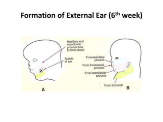 Formation of External Ear (6th week)
 