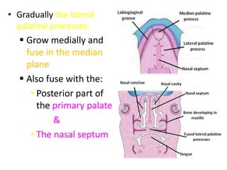 • Gradually the lateral
palatine processes:
 Grow medially and
fuse in the median
plane
 Also fuse with the:
• Posterior part of
the primary palate
&
• The nasal septum
 