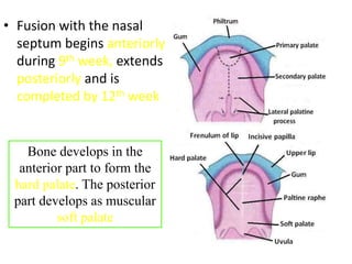 • Fusion with the nasal
septum begins anteriorly
during 9th week, extends
posteriorly and is
completed by 12th week
Bone develops in the
anterior part to form the
hard palate. The posterior
part develops as muscular
soft palate
 
