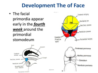 Development The of Face
• The facial
primordia appear
early in the fourth
week around the
primordial
stomodeum
md
md
FN
S
4
Prof. Makarem
MX
MX
 