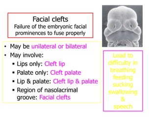 Facial clefts
Failure of the embryonic facial
prominences to fuse properly
• May be unilateral or bilateral
• May involve:
 Lips only: Cleft lip
 Palate only: Cleft palate
 Lip & palate: Cleft lip & palate
 Region of nasolacrimal
groove: Facial clefts
Lead to
difficulty in
breathing
feeding
sucking
swallowing
&
speech
 