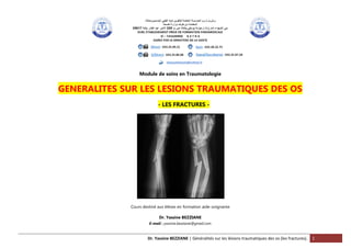 Dr. Yassine BEZZIANE | Généralités sur les lésions traumatiques des os (les fractures). 1
Module de soins en Traumatologie
GENERALITES SUR LES LESIONS TRAUMATIQUES DES OS
- LES FRACTURES -
Cours destiné aux élèves en formation aide-soignante
Dr. Yassine BEZZIANE
E-mail : yassine.bezziane@gmail.com
 