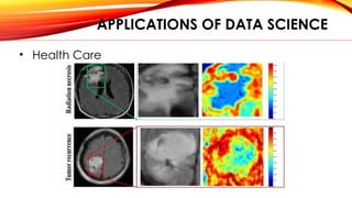 APPLICATIONS OF DATA SCIENCE
• Health Care
 