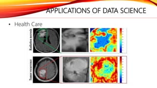 APPLICATIONS OF DATA SCIENCE
• Health Care
 