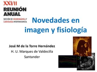 Novedades en
imagen y fisiología
José M de la Torre Hernández
H. U. Marques de Valdecilla
Santander
 