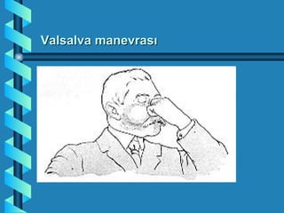 Valsalva manevrası
 