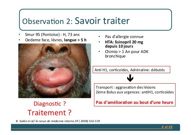 Lisinopril fachinformation Apotheke