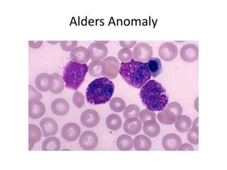 Alders Anomaly