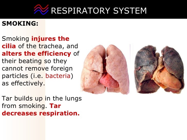 03 respiratory system2