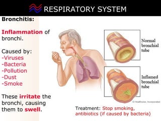 03 respiratory system2 | PPT