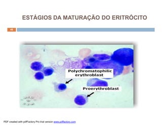 ESTÁGIOS DA MATURAÇÃO DO ERITRÓCITO
     49




PDF created with pdfFactory Pro trial version www.pdffactory.com
 