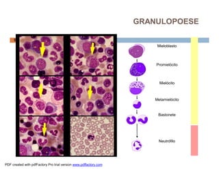 GRANULOPOESE

     58
                                                                        Mieloblasto



                                                                       Promielócito



                                                                         Mielócito



                                                                       Metamielócito


                                                                        Bastonete




                                                                        Neutrófilo




PDF created with pdfFactory Pro trial version www.pdffactory.com
 