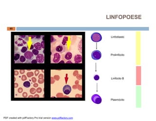 LINFOPOESE
     65


                                                                    Linfoblasto




                                                                    Prolinfócito




                                                                    Linfócito B




                                                                    Plasmócito




PDF created with pdfFactory Pro trial version www.pdffactory.com
 