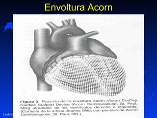 Envoltura Acorn 