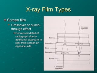 Inverted Radiographic Film 03 xray film etc | PPT