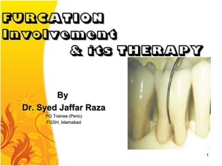ByBy
Dr. Syed Jaffar RazaDr. Syed Jaffar Raza
PG Trainee (Perio)PG Trainee (Perio)
FGSH, IslamabadFGSH, Islamabad
1
FURCATIONFURCATION
InvolvementInvolvement
& its THERAPY& its THERAPY
 