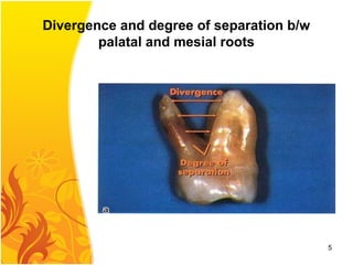 Divergence and degree of separation b/w
palatal and mesial roots
5
 