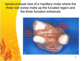Apical-occlusal view of a maxillary molar where the
three root cones make up the furcated region and
the three furcation entrances
6
 