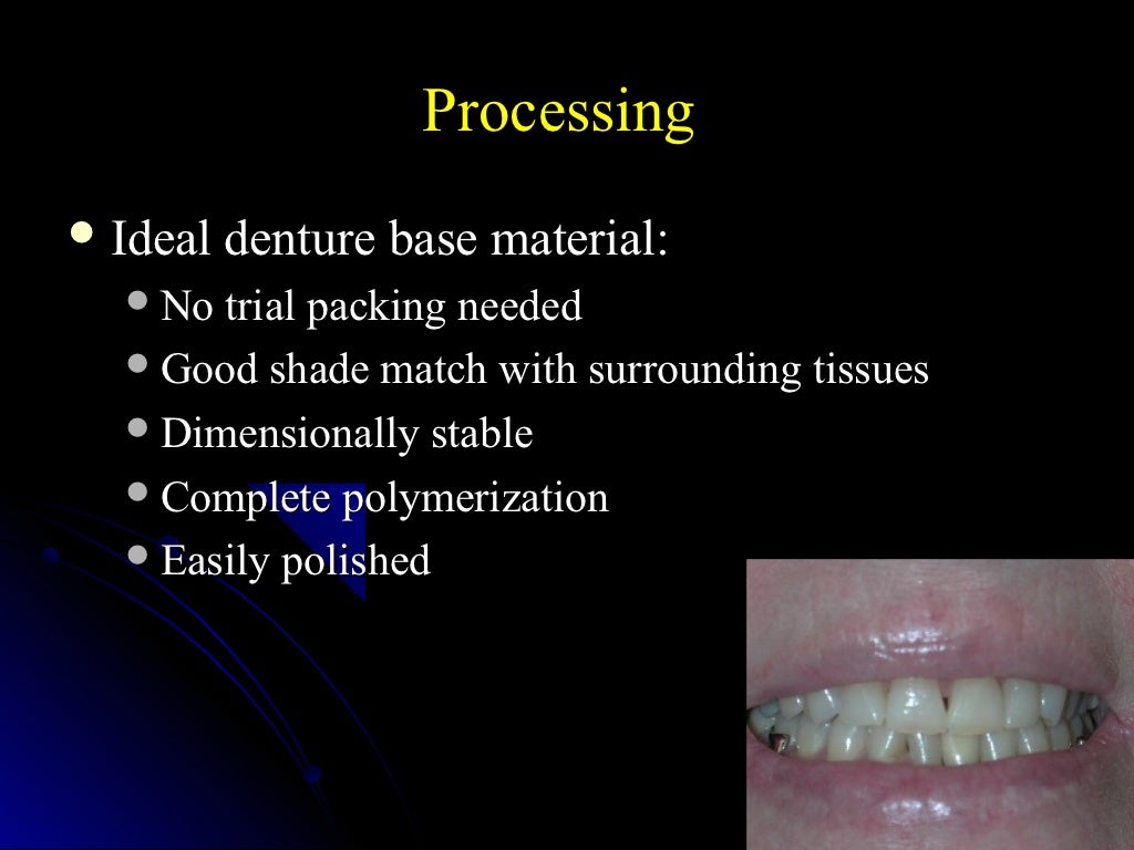 03 01 01_45(flasking and processing complete denture)