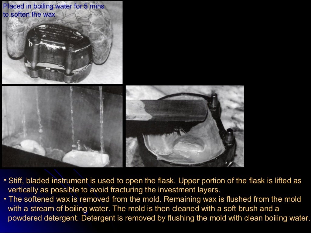 03 01 01_45(flasking and processing complete denture)